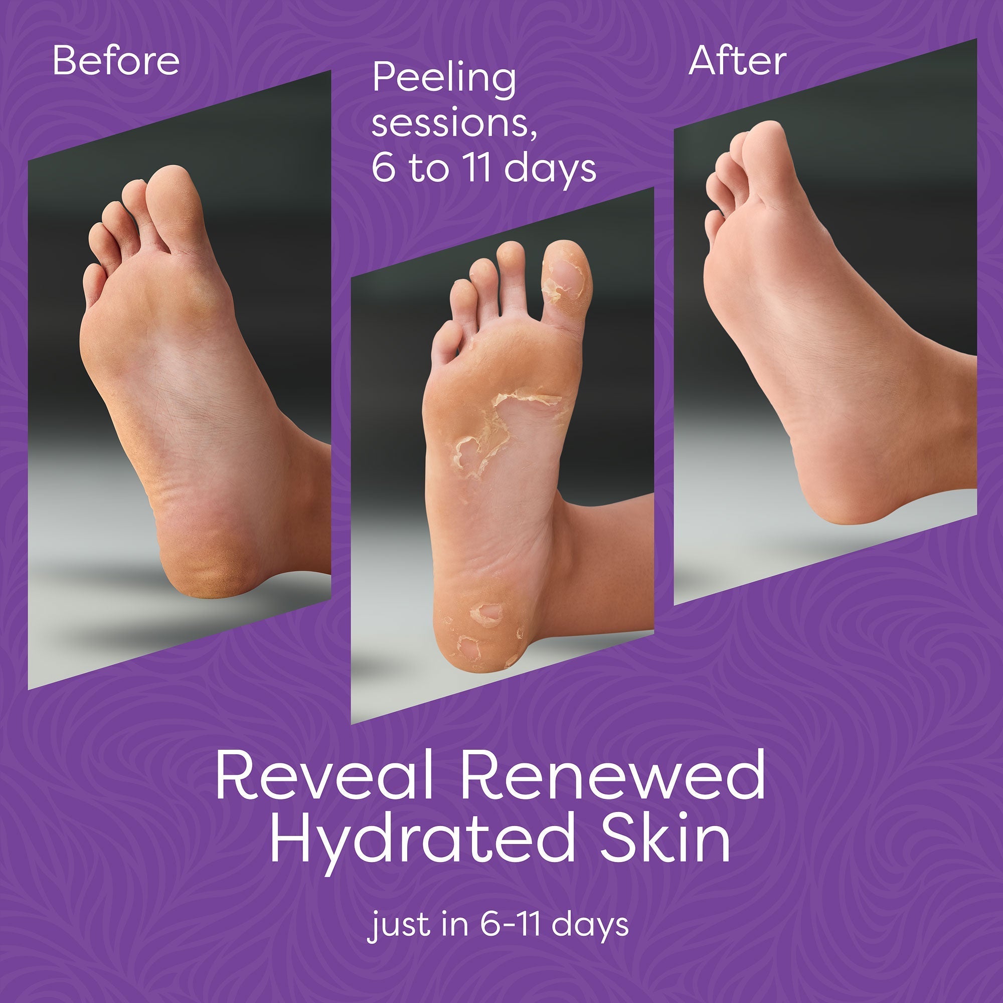 Aesta 3-in-1 Foot Peel Mask, Full-Cycle Foot Care: Revitalizing Mousse, 3-in-1 - in use