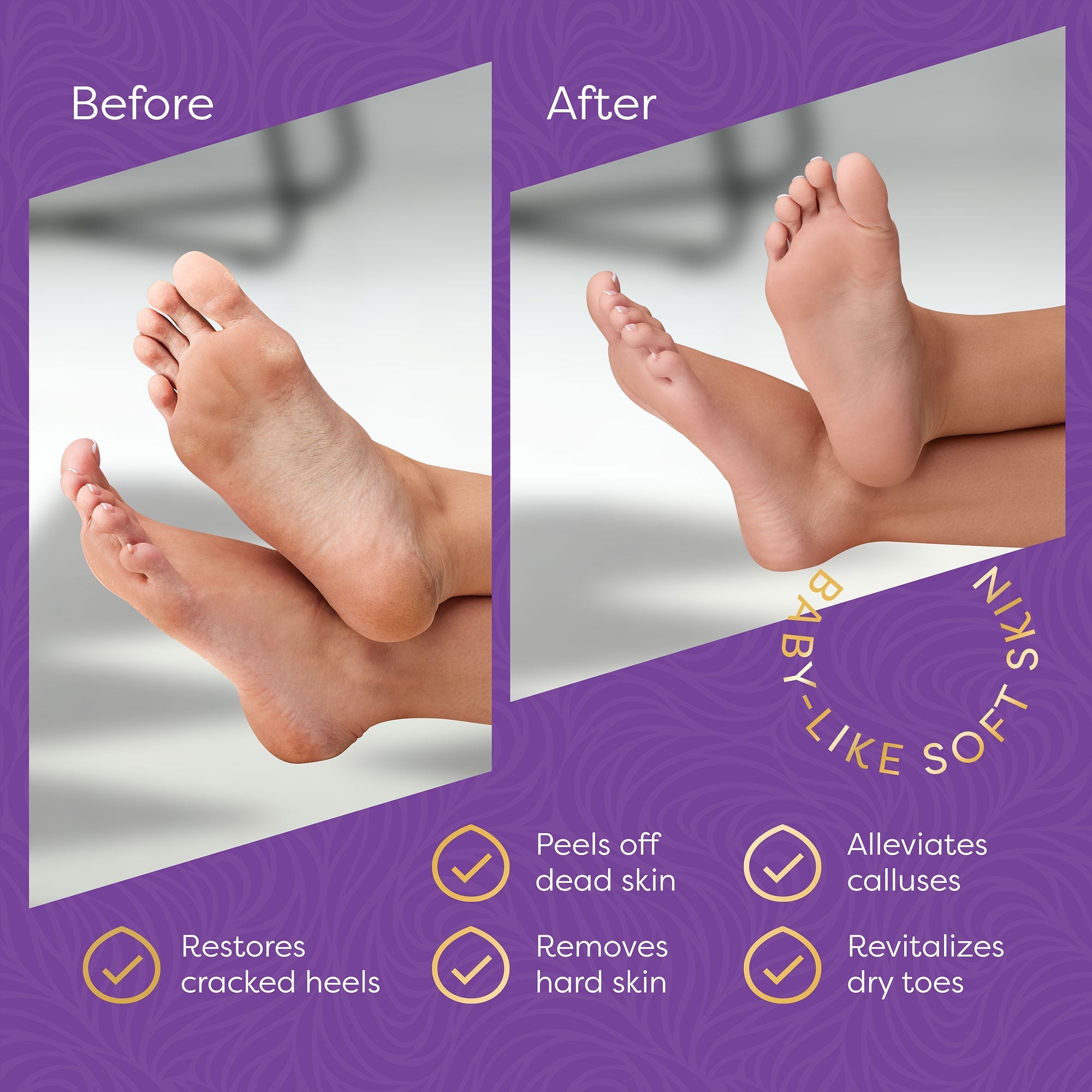 Aesta 3-in-1 Foot Peel Mask, Full-Cycle Foot Care: Revitalizing Mousse, 3-in-1 - detail