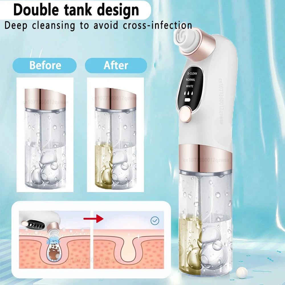 Blackhead Remover Tool - detail