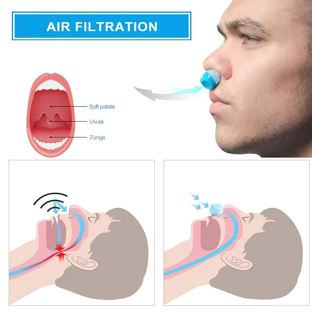 Airing Micro-CPAP Device for Hassle-Free Anti-Snoring Relief - alternate angle