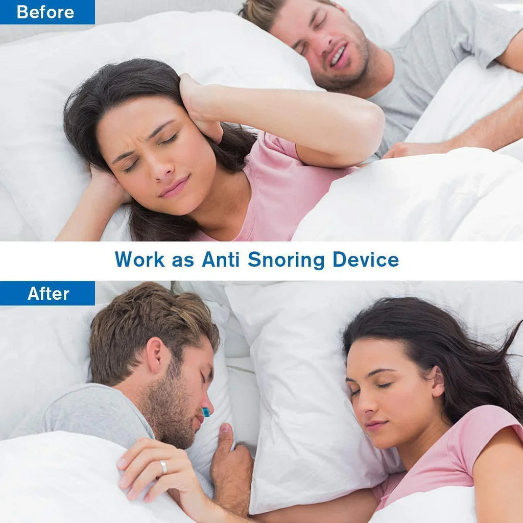Airing Micro-CPAP Device for Hassle-Free Anti-Snoring Relief - detail