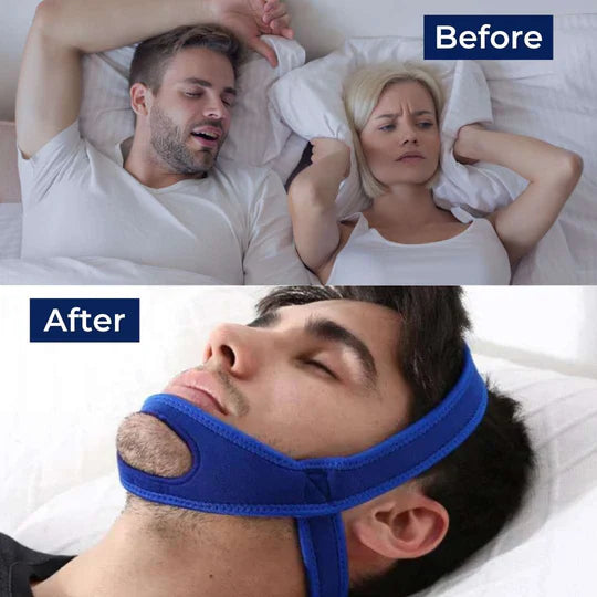 Full Head Chin Strap for Snoring Relief | Sleep Apnea Support