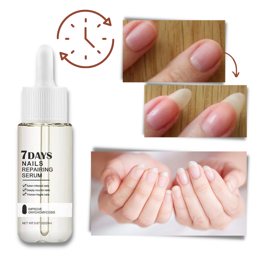 7 Days Nail Repair Essence - 20ml Nourishing Nail Strengthener Serum - detail