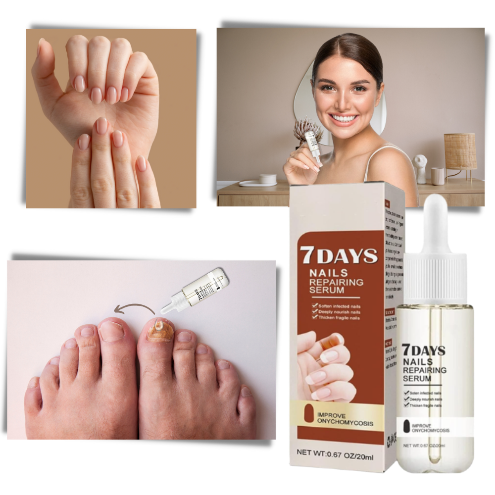 7 Days Nail Repair Essence - 20ml Nourishing Nail Strengthener Serum