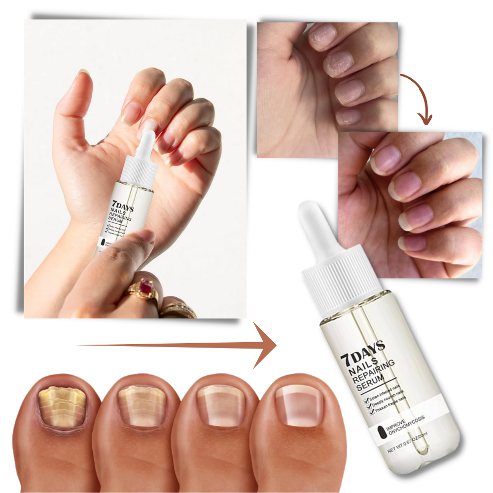 7 Days Nail Repair Essence - 20ml Nourishing Nail Strengthener Serum