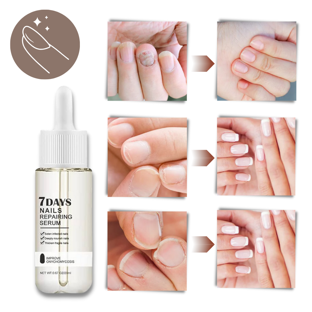 7 Days Nail Repair Essence - 20ml Nourishing Nail Strengthener Serum - detail