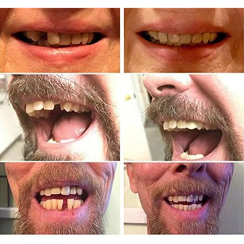 High-Quality False Teeth - detail