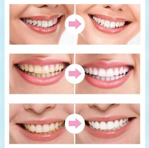 Dental Whitening Pen - detail