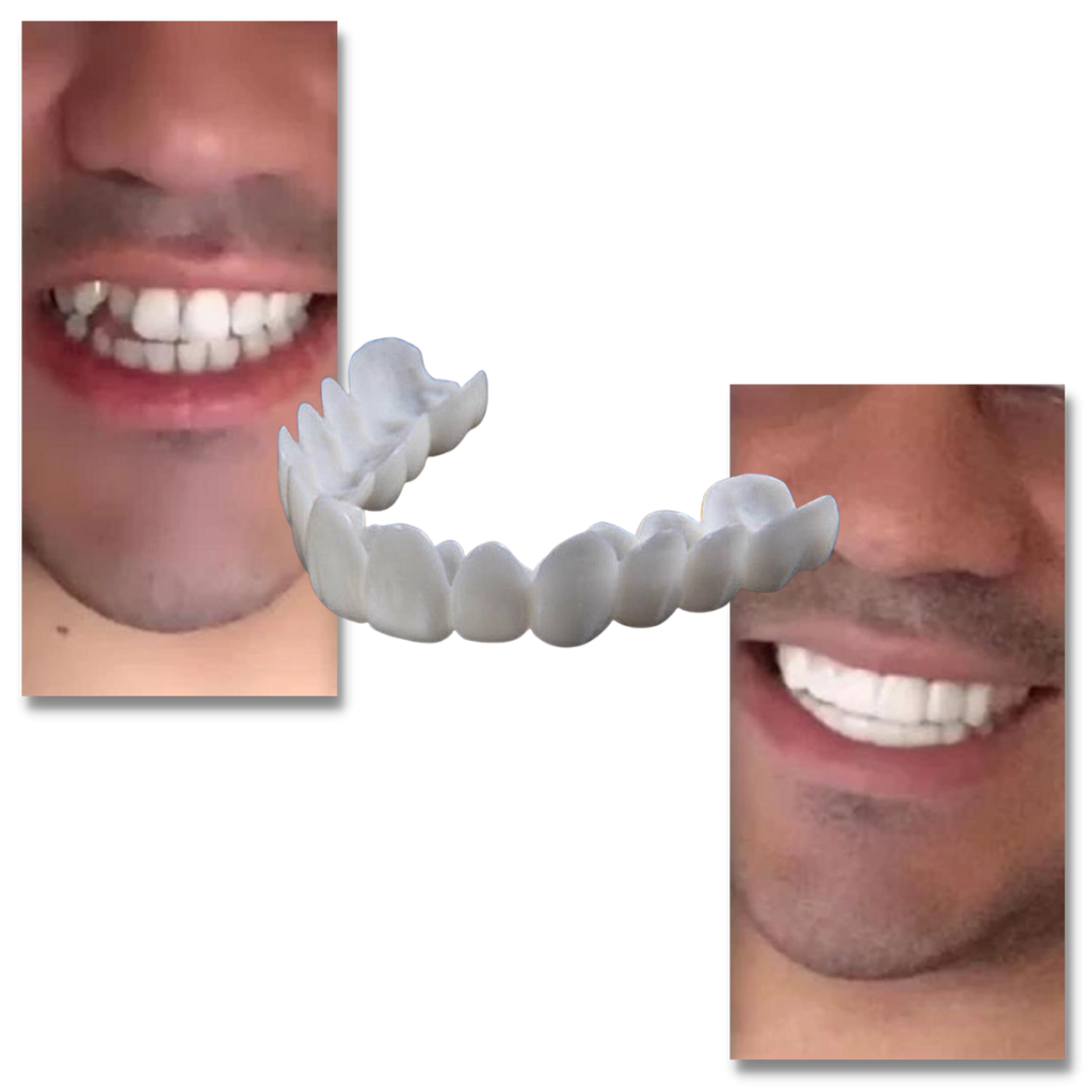 Dental coverage for a perfect smile - comfortable aligners - detail