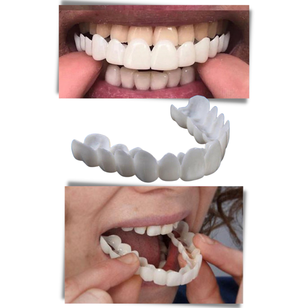 Dental coverage for a perfect smile - comfortable aligners - detail