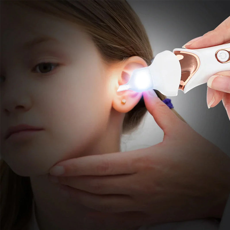 5-in-1 Electric Earwax Remover with Interchangeable Tips for Safe, - detail