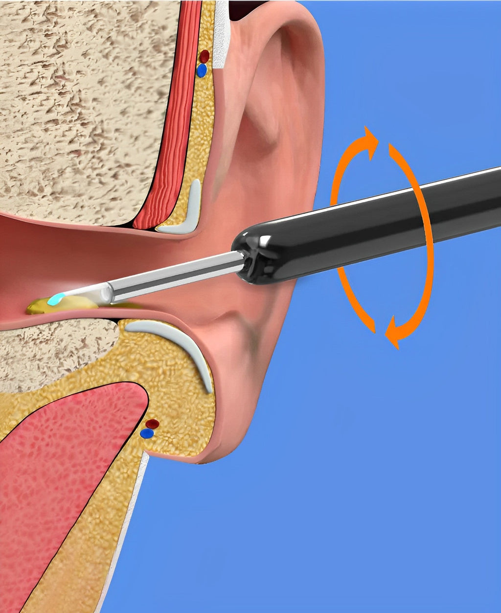 EarBit 3000 - Ear Cleaning Tool With a Camera - in use