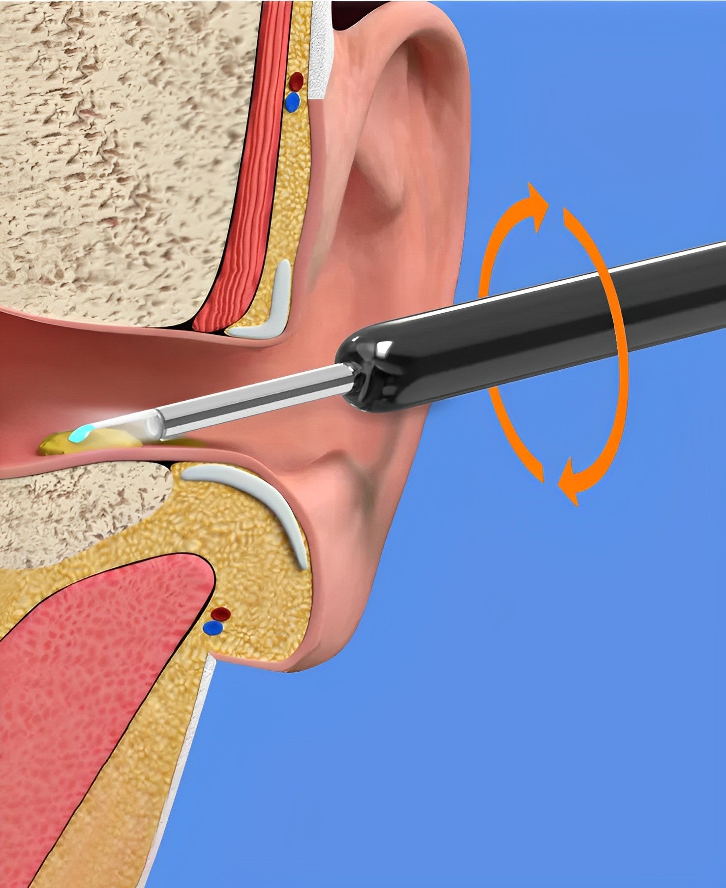EarBit 3000 - Ear Cleaning Tool With a Camera - in use