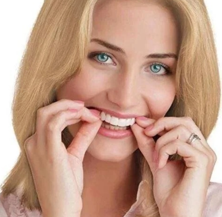 Adjustable Snap-On Dentures - alternate angle