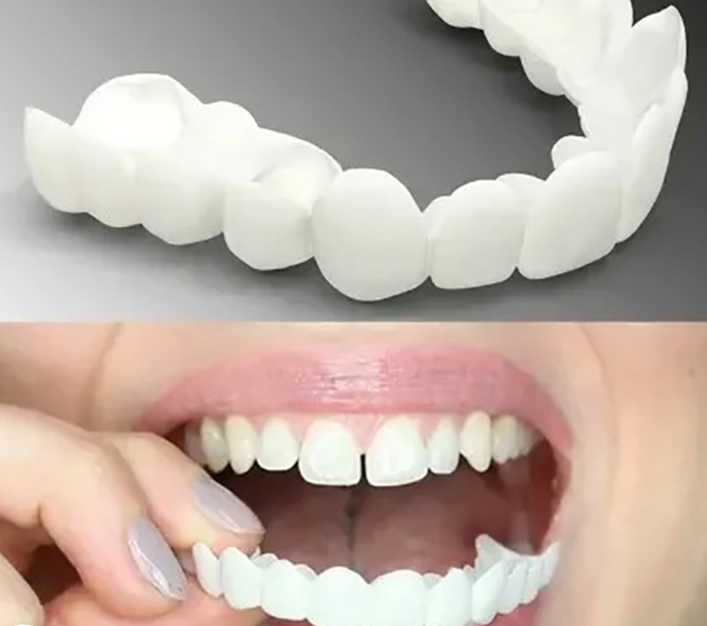 Adjustable Snap-On Dentures - detail