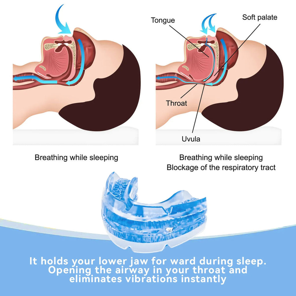 Adjustable Anti Snore Mouthpiece - detail