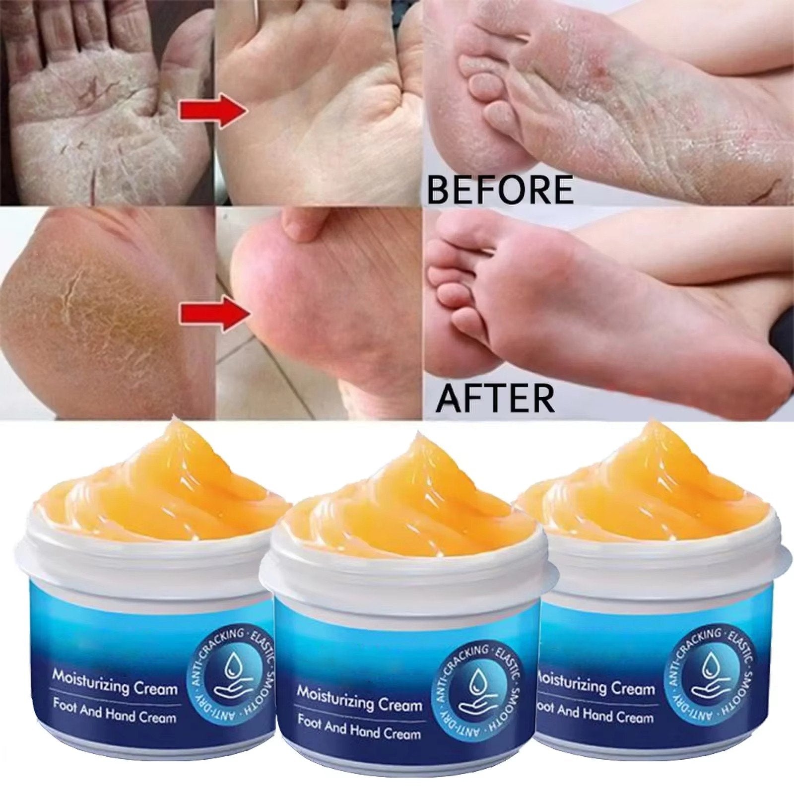Cracked Foot Heel Treatment 3 Pack - detail