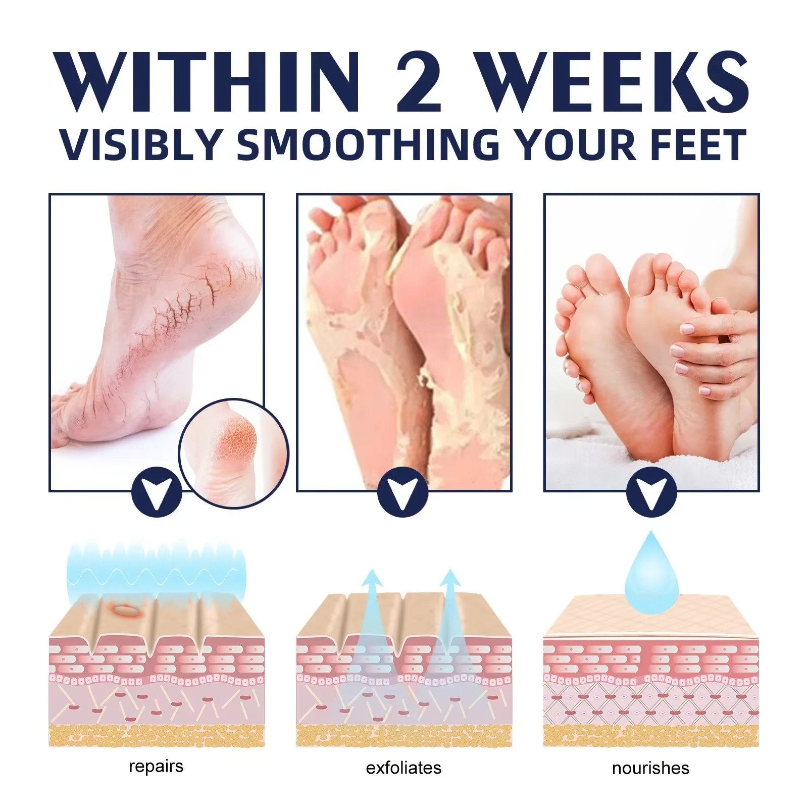 Cracked Foot Heel Treatment 3 Pack - alternate angle