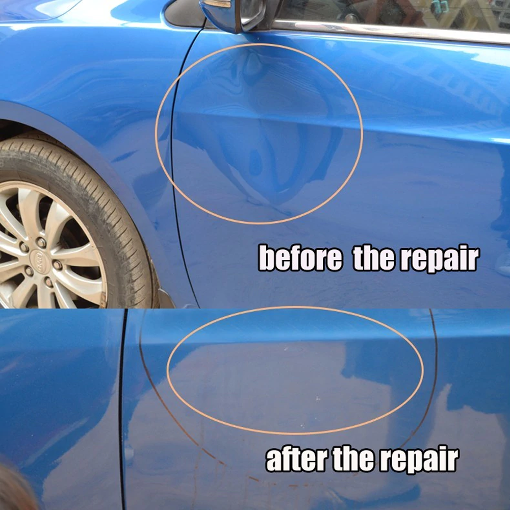 Easy DIY Car Dent Removal Tool Kit - detail