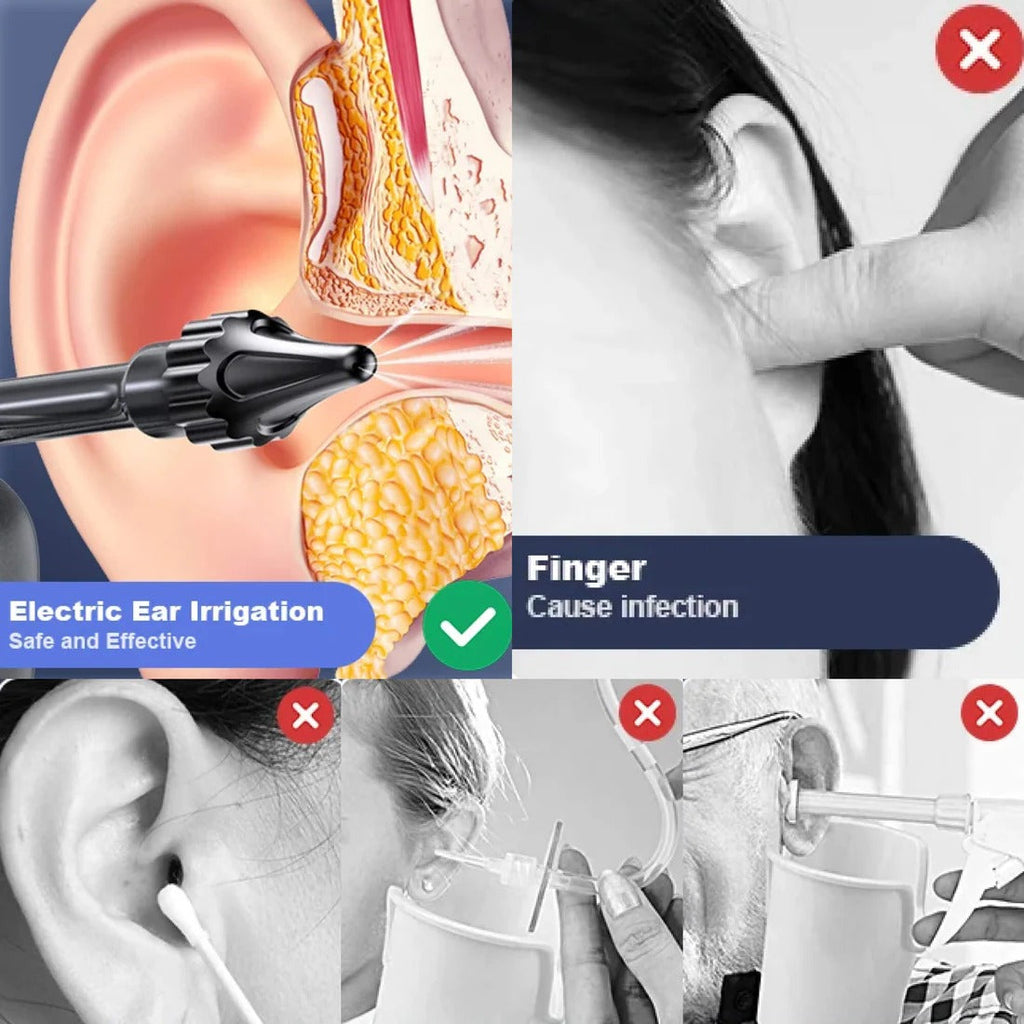 Ear Cleaning Irrigation Tool - alternate angle