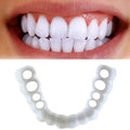 Facial Tooth Cover Retainer - alternate angle