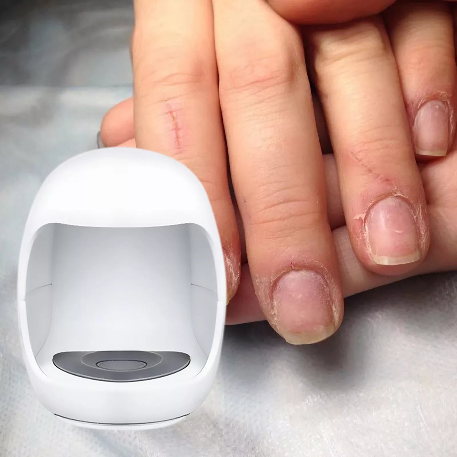 Fungal Laser Toe Treatment Clip On Device - detail
